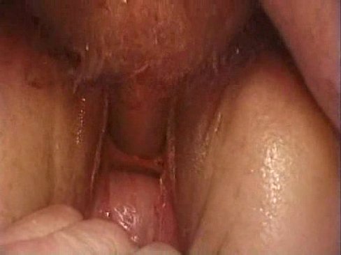 best of With creampie sounding fuck peehole
