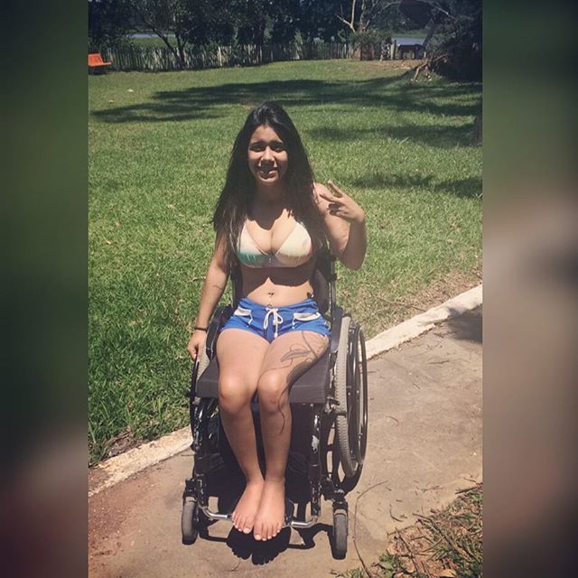 Paraplegic Nude