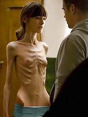 Skinny anorexic nude girls having sex