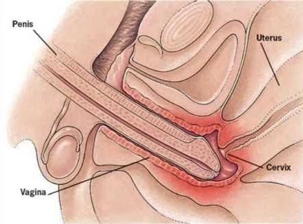 Orgasm sex How to insert penis in vagina.