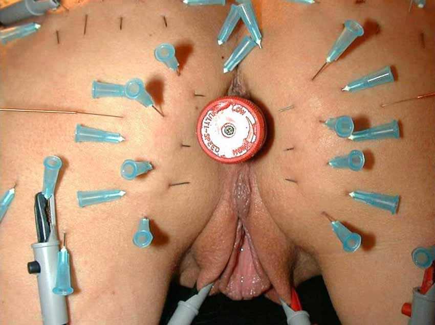 best of Ass needles