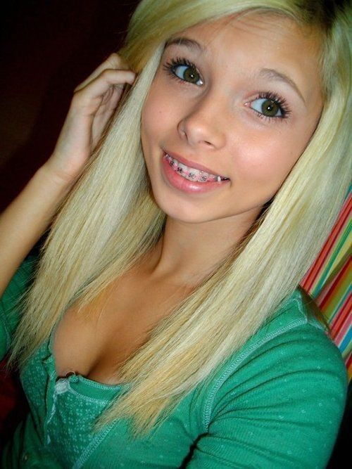 Teens Braces On Teeth Naked Gallery Porn Full HD Image FREE Comments 1